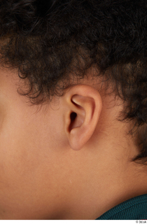 Photos of Laelim Dorsey ear 0001.jpg